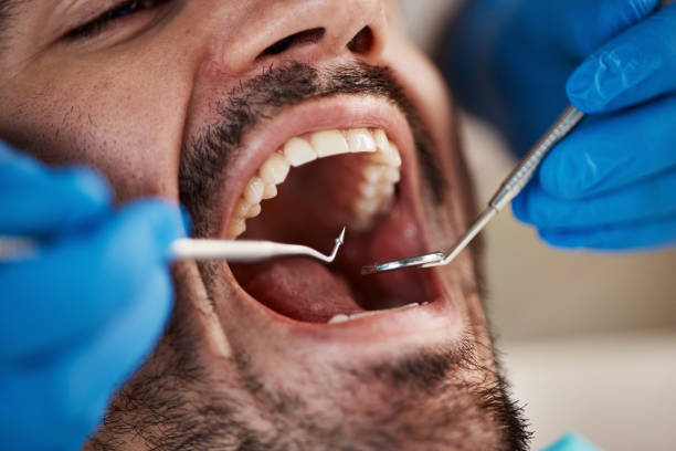 Emergency Dentist for Kids in KY